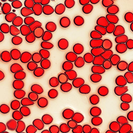 Blood cells on glass