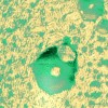 adhesion