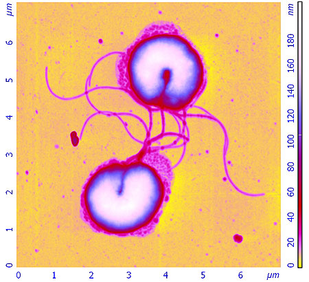 Helicobacter_pylori_1