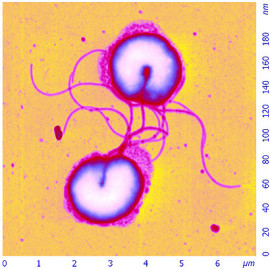 Helicobacter pylori