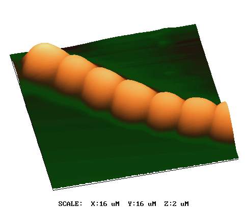 anabaena